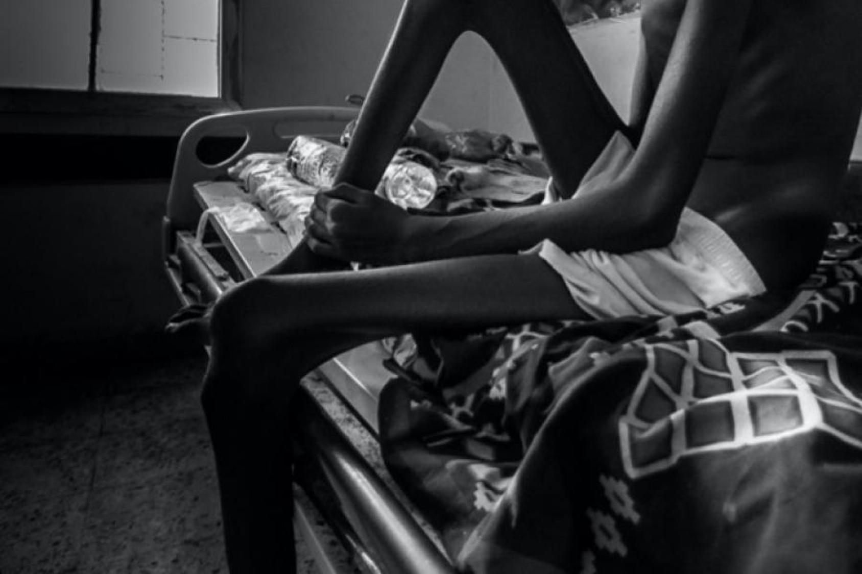 一个严重营养不良的人坐在床上，抱着自己的腿。