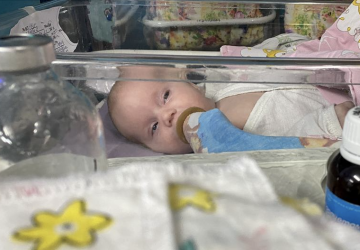 一个婴儿躺在一个塑料摇篮里，嘴里插着一根氧气管。
