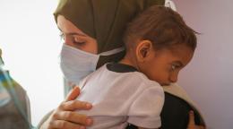طفل يتلقى العلاج من سوء التغذية في أحد مستشفيات صنعاء، اليمن. 