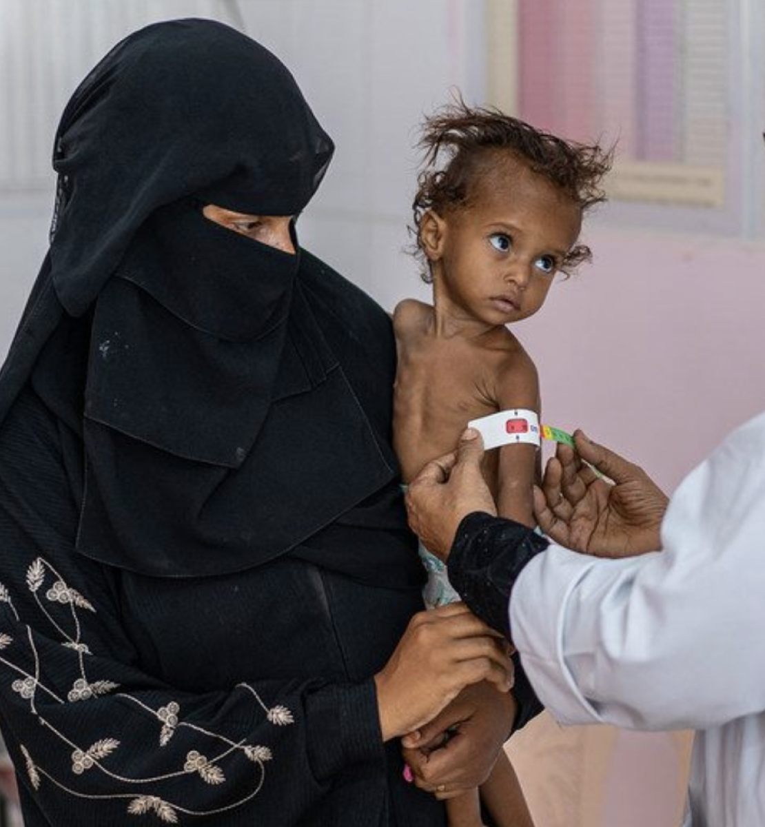 Une femme portant un voile noir lui couvrant le visage tient un enfant atteint de malnutrition sévère dans les bras, tandis qu'une infirmière mesure le diamètre du bras gauche de l'enfant.