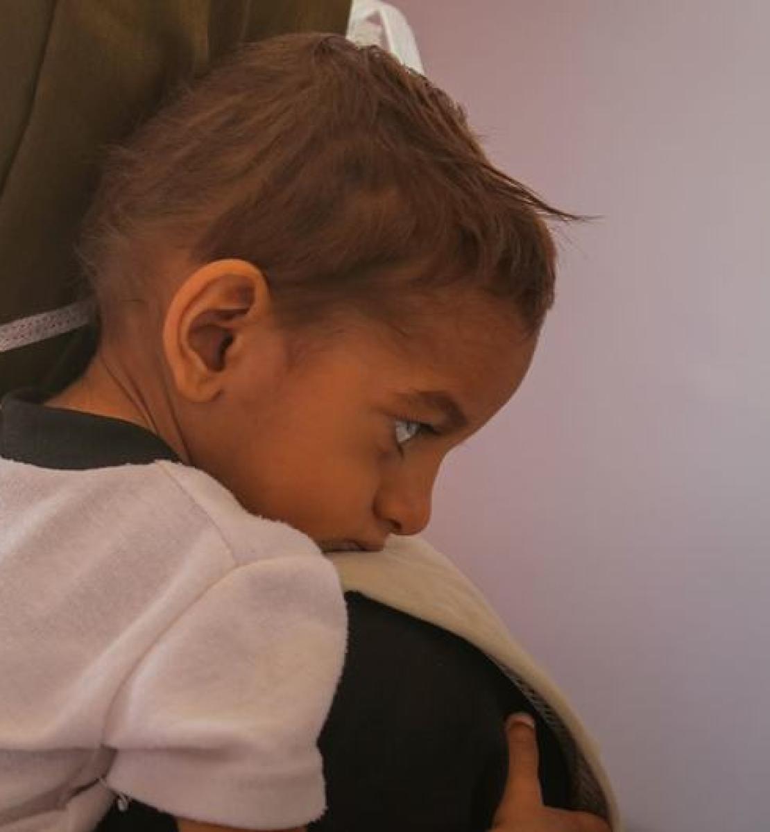 طفل يتلقى العلاج من سوء التغذية في أحد مستشفيات صنعاء، اليمن. 