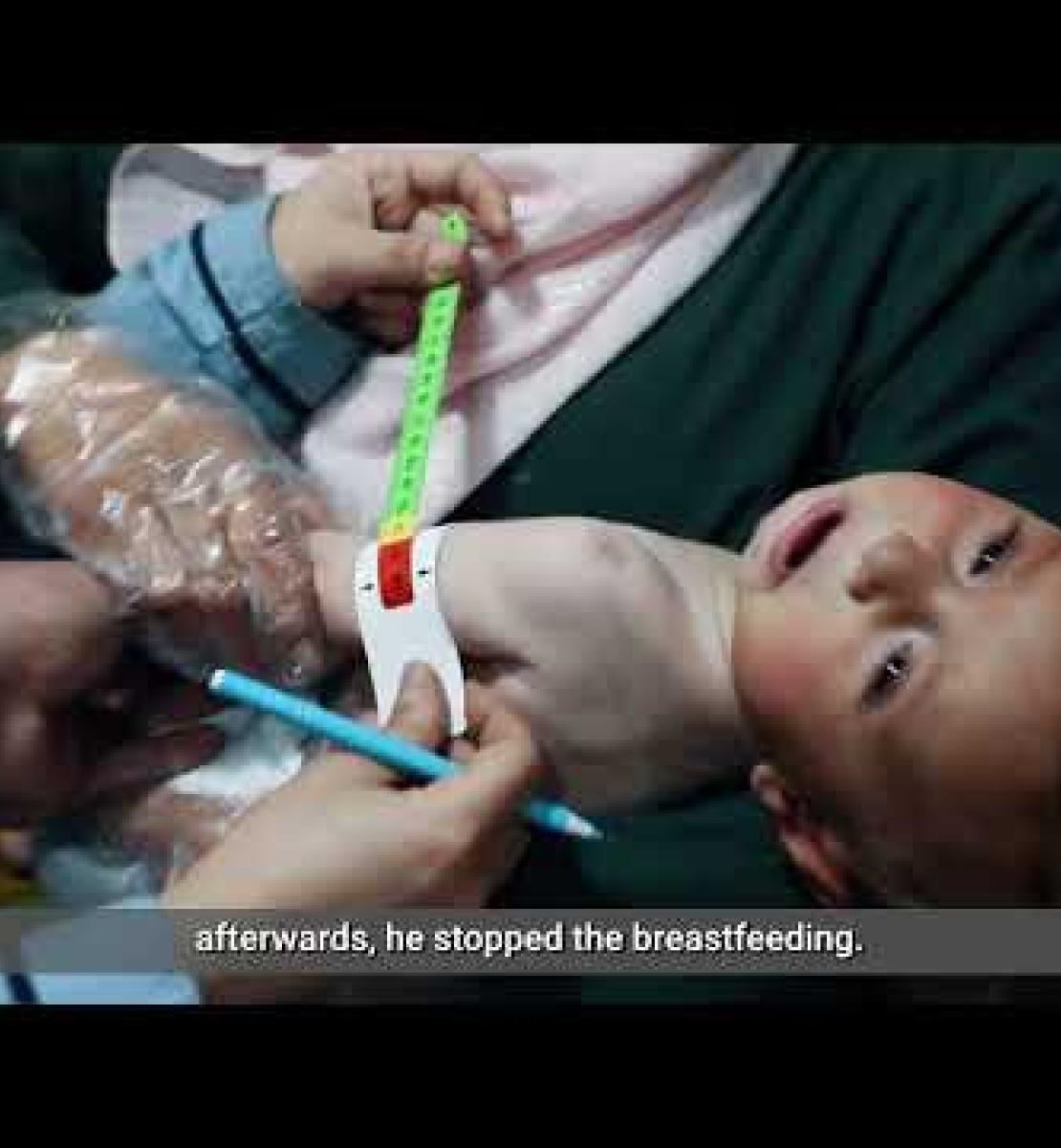 Des efforts concertés pour sauver les enfants souffrant de malnutrition dans le nord-est de la Syrie 