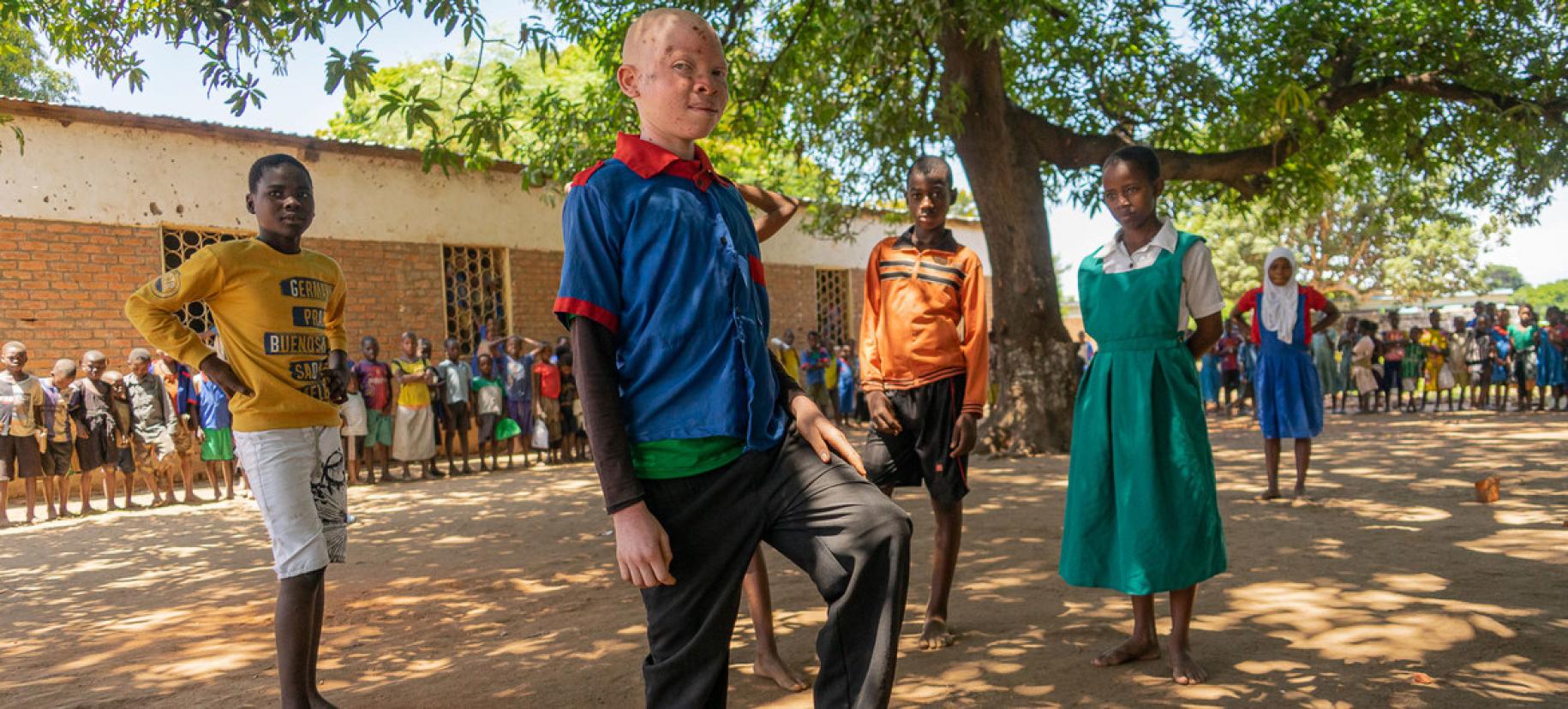 Chinsisi Jafali, a 14-year-old with albinism in Malawi stands proudly alongside his classmates.