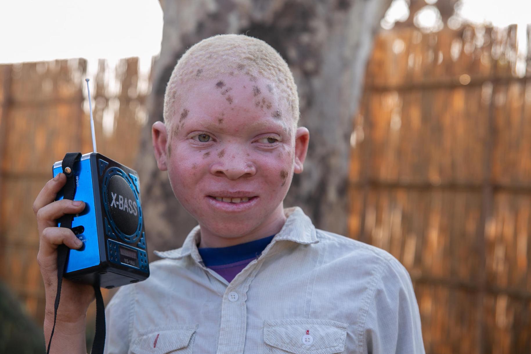 Chisisi Jafali, 15 years, in standard 5, holds a small radio, which he uses to listen to his lessons.